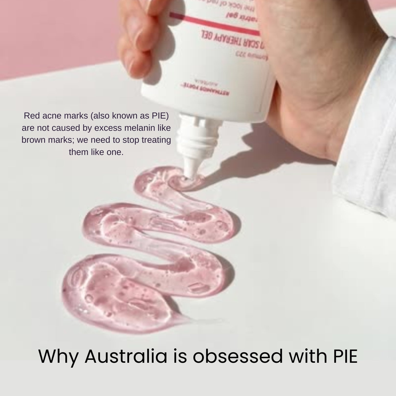 how to remove red acne marks