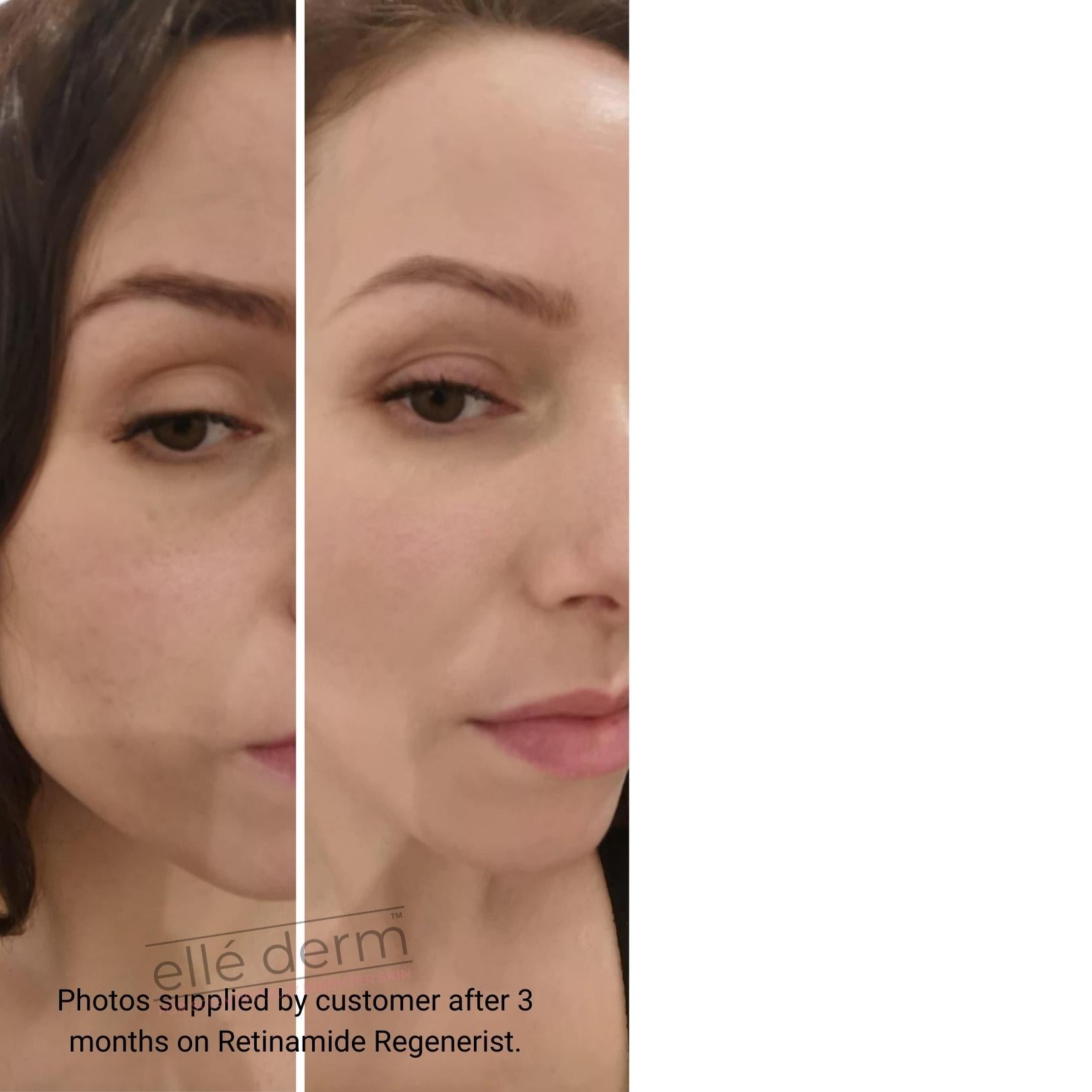 Retinamide Regenérist Emulsion 50ml