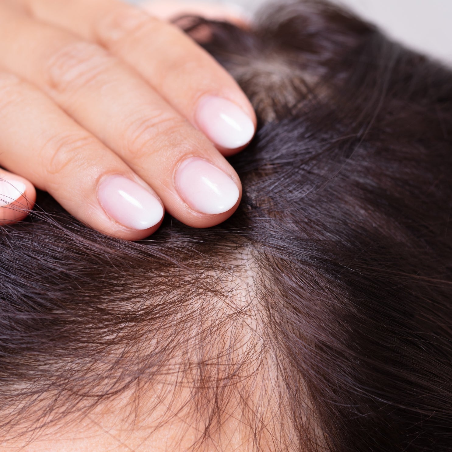 menopausal hair loss