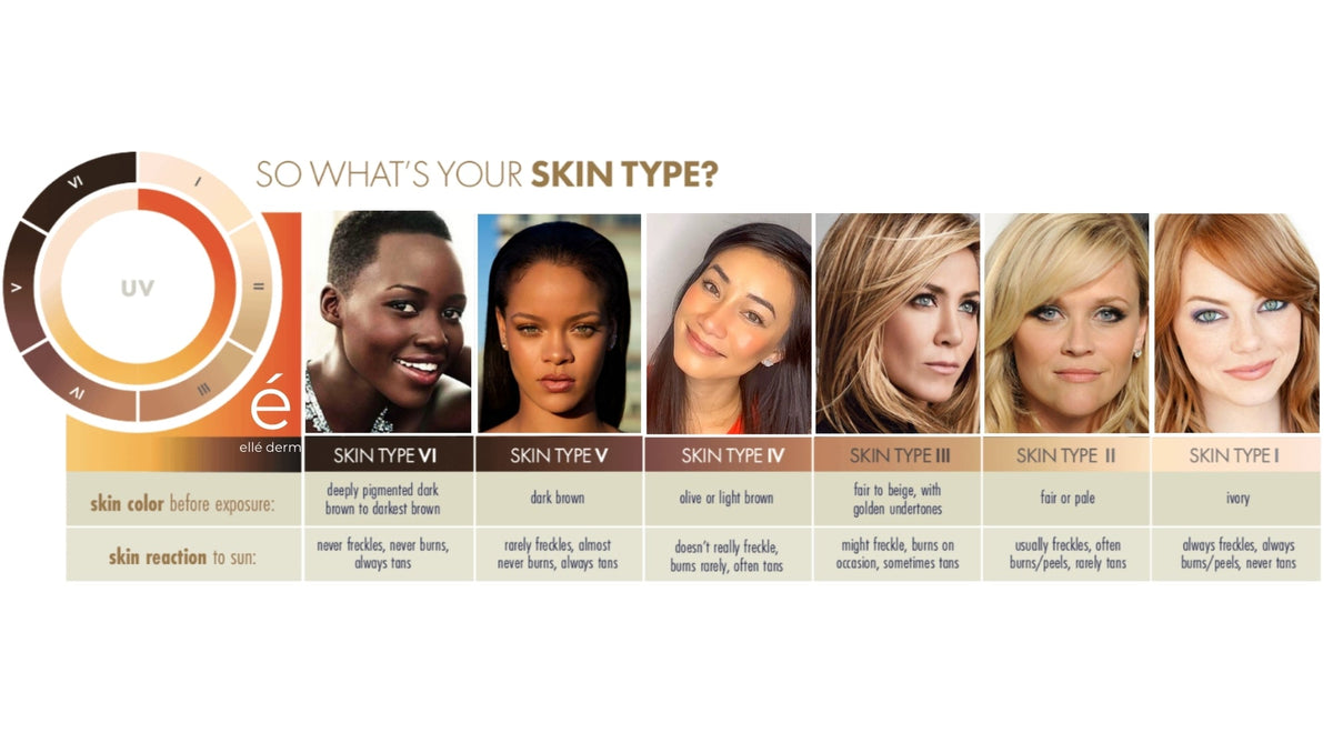 What is your skin type? - The Fitzpatrick Skin Scale – ellé derm australia