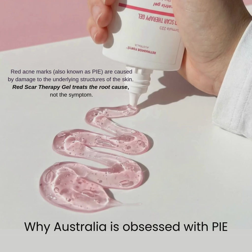 how to remove red acne scars